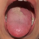2011/04/13　舌の写真