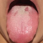 2012/10/03　舌の写真