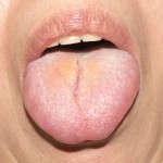 2013/01/27(二診目)No.27