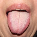 2013/01/26(初診)No.27