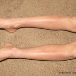 アトピー患者　望診　足