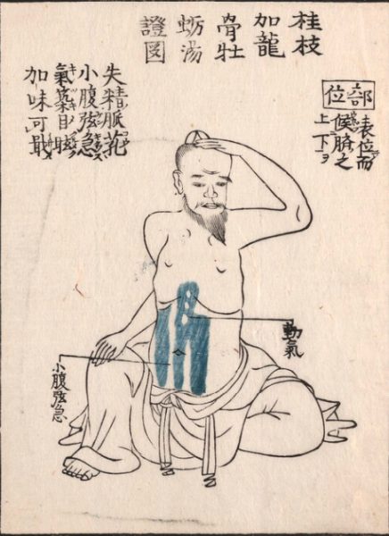 桂枝加竜骨牡蠣湯