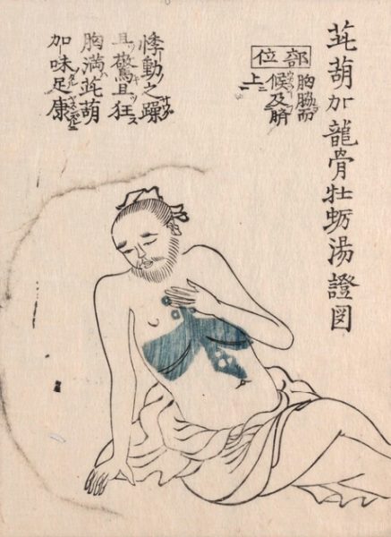 柴胡加竜骨牡蠣湯