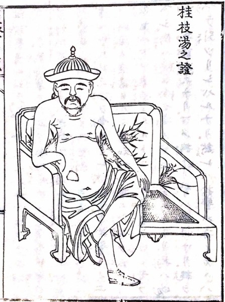 桂枝湯