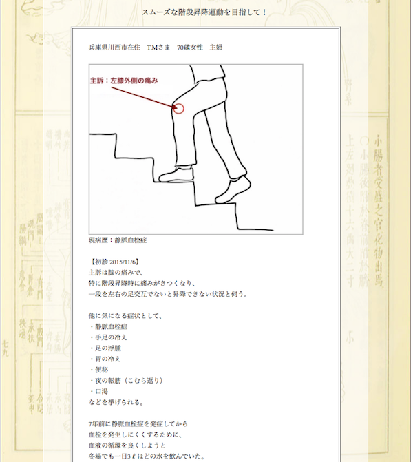 【症例集】膝の痛み：兵庫県川西市のT.M様