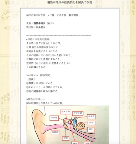 【症例集】慢性中耳炎:神戸市中央区のA.Y様
