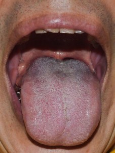 舌診学NO.45