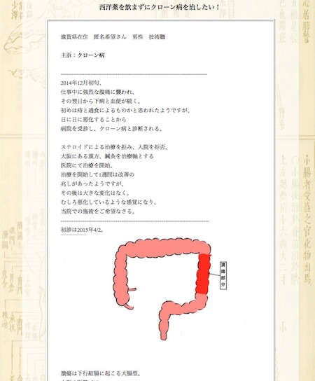 【症例集】クローン病:滋賀県の匿名希望様
