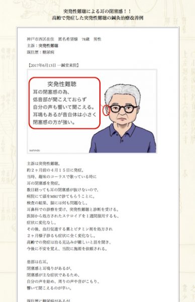 【症例集】突発性難聴：神戸市西区の匿名希望様