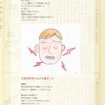 【疾患別解説】歯ぎしり