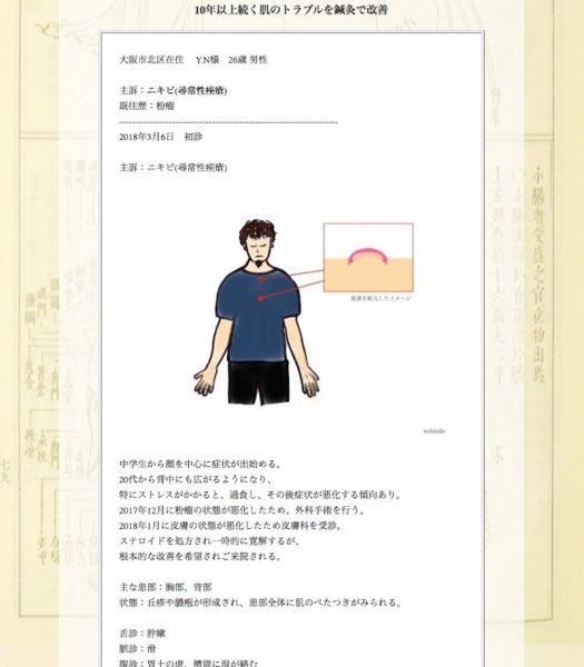 ニキビ(尋常性痤瘡)：大阪市北区のY.N様