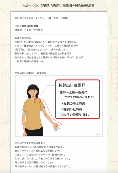 【症例集】胸郭出口症候群：神戸市中央区のR.S様